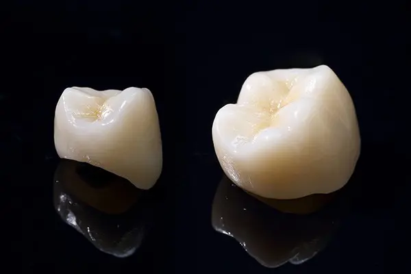 03 自然な美しさ、精密なセラミック治療で実現